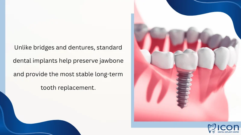 Alternatives Bridges, Dentures, and Mini Implants