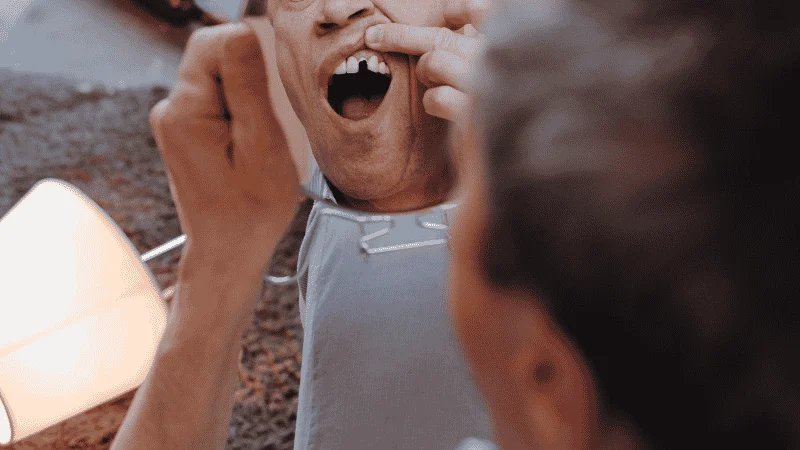 Bone Loss After Tooth Loss