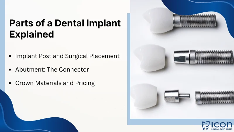 Understanding the Components of a Dental Implant