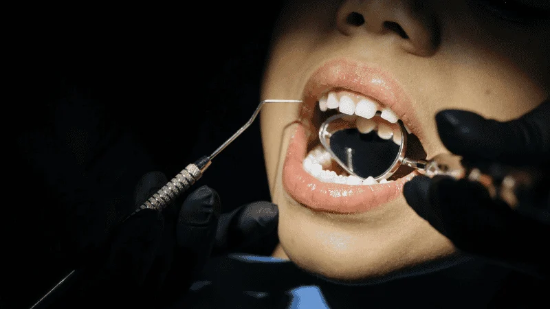 when to consider dental implants